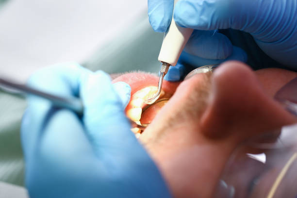 Best Emergency Root Canal Therapy in Pampa, TX